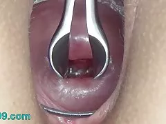 Cuello sexo xxx caliente uterino estiramiento ancho con espéculo y el esperma en el útero