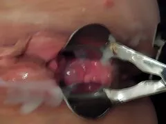 Creampie de espéculo